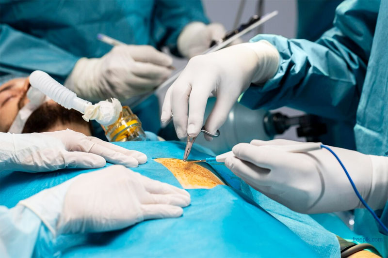 Why Minimally Invasive Surgery in Gynecologic Cancers Is Gaining Popularity Nowadays?